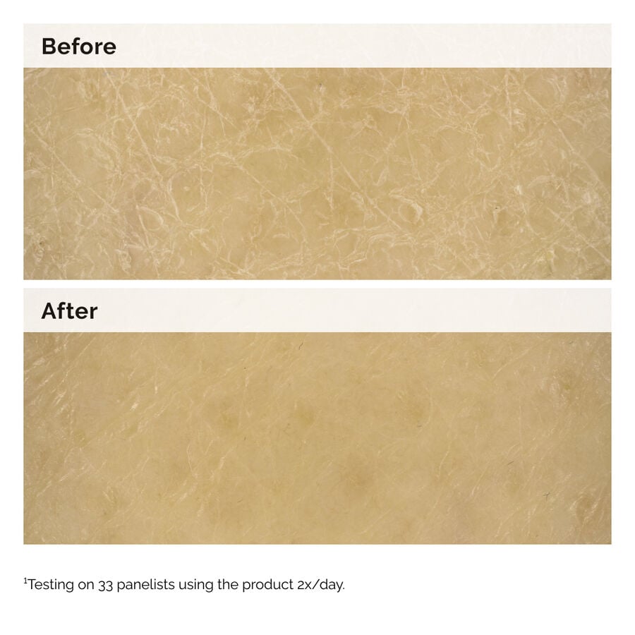 Before and After close-up images of skin. The 'Before' image shows very dry, cracked skin. The 'After' image shows the skin is visibly smoother and more hydrated, demonstrating the body lotion's effectiveness.
